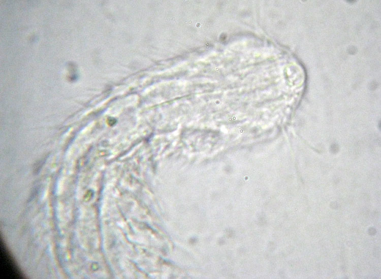 Due Gastrotricha  -  Chaetonotus sp.